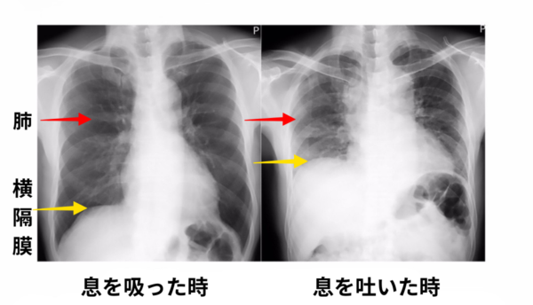 横隔膜の位置と動きの図解